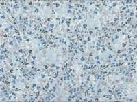 Blätter hellblau Blätter hellblau